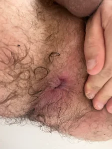 rubben25 Public Foto 4