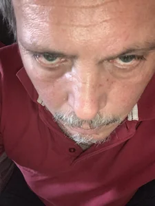 Toskito $$ Billede 2