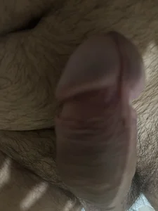 CCPIRESP…zao molhado图片 2