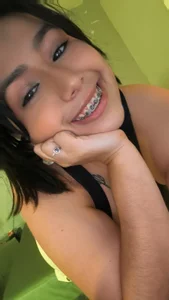 Zdjęcia emmajohnss Smile braces:  2
