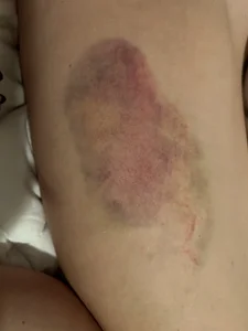 MissMaggie Bad accident Foto 5