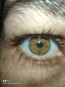 Dark__Elf Public Pic