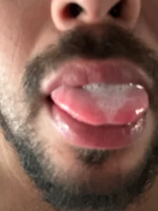 Rodrigopraba Gay lips 圖片