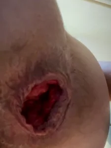 Zdjęcia Prolapse_Pig Public: 