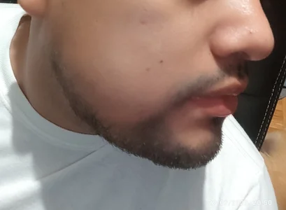 Hotknight Face 😚 صورة واحدة|Hotknight Face 😚 صورتان|Hotknight Face 😚  صور|Hotknight Face 😚  صورة