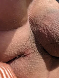 Me de biologe  2 photos