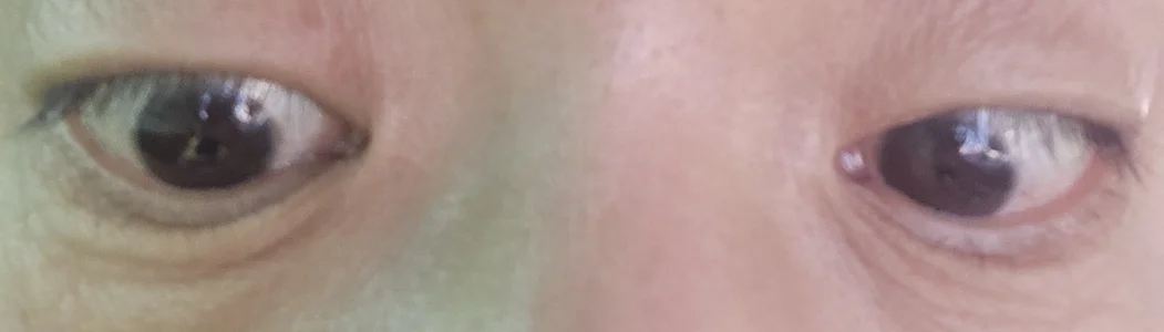 Korea-Kiss 나의부위별♡ Pic