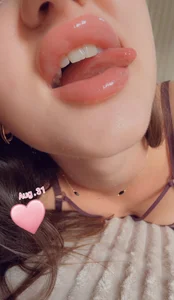 Fortune_888 Kiss-kiss Hình 2