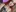 My smile (this is shock content)