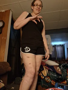 Teazy17 Public slika 4