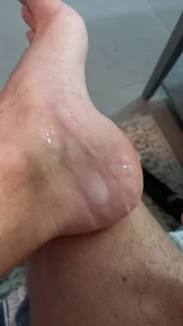 ภาพนู้ด XXX ของ FeetForTips 3 รูป