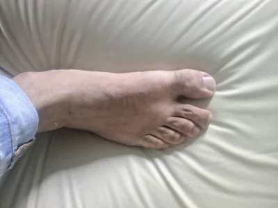iram_pretty_foot Foot Bilde 2
