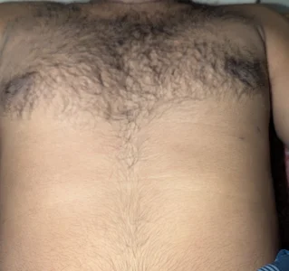 Hairy Body