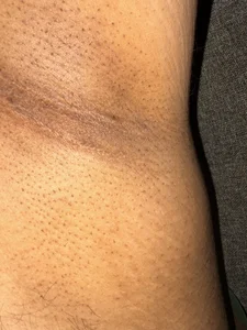 ashishs1207 Free lollipops Εικόνα 2