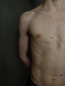 Lewis_and_Marta Lewis 사진