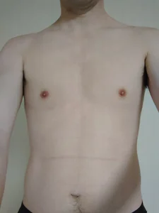 techi315's XXX Nude Photo 3