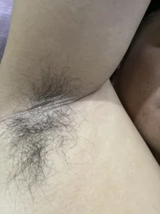 腋下 od Cunzhangshibage02  6 snímek