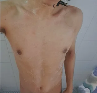 Dermental 🥴💦🥵 Foto 2