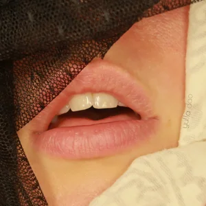 yulladao essayage Pic