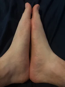 Pieds de Mecvierge  5 Imagens