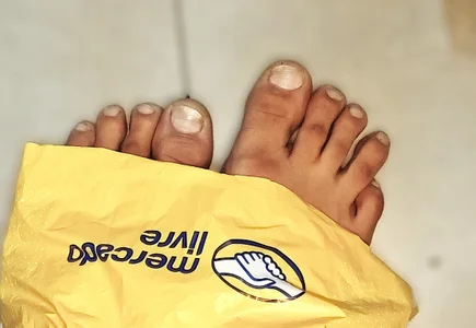 Machoprostatico kullanıcısının Patas sucias albümü -  3 fotoğraf