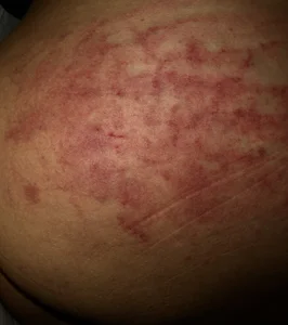 witchdub 💘 صورة واحدة|witchdub 💘 صورتان|witchdub 💘  3 صور|witchdub 💘  3 صورة