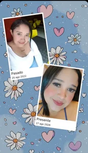 BustyyJuicy_Rs A Before and After - {count, plural, one {תמונה אחת} two {שתי תמונות} many {# תמונות} other {# תמונות}}