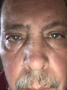 Toskito More Billede