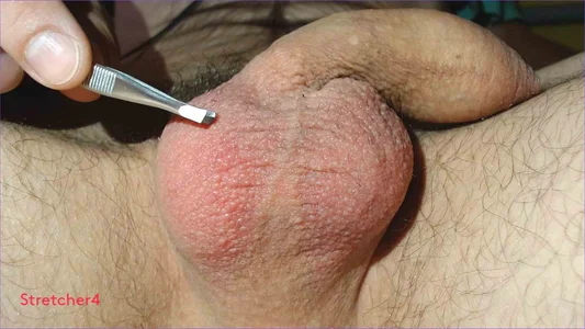 Stretcher4 Public зображення 4