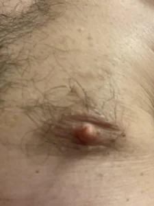 PoisPleasure Public รูป  3