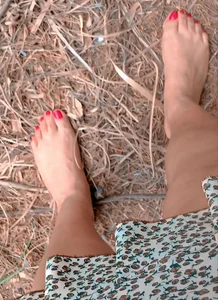 Public de AuroraChest  Imagens