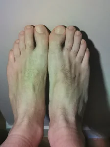 franckrigogne Pieds Foto 2