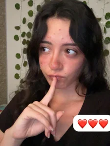 I'm sick of chickenpox, see you in 2 weeks :( de emma_unu Foto