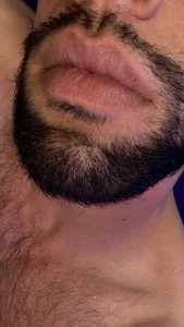 Karim_mansur Mouth and lips รูป  6
