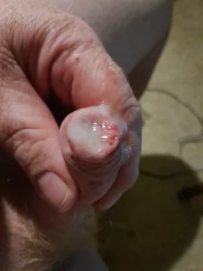 Kiroki77 Public Εικόνα