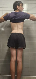 Skinny_freakPublic Bild