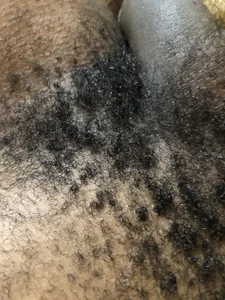 You de MzansiMonster  photos