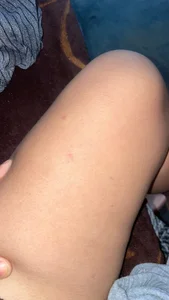 Cosita de caatty  2 Imagens