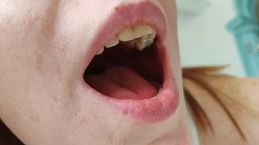 FENIX_ZLA FETISH: teeth Bilde 3