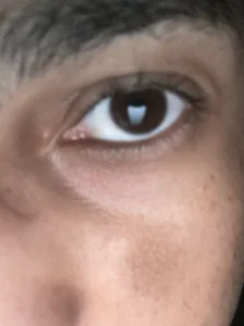 pauzudomoreno1 Eyes Foto