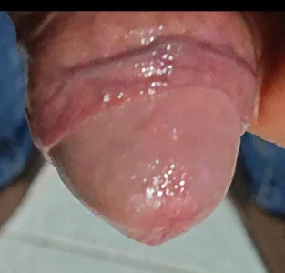 jhonschen's Che dite è fotogenico? Sex Photo 2