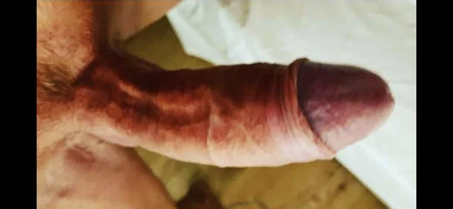 Public de BodoBanger1  4 Imagens