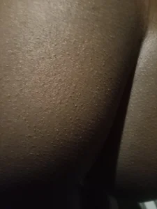 Public