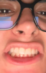 Monst3rc00ck A summary of the worst year of my life (at least I looked pretty) Foto 3