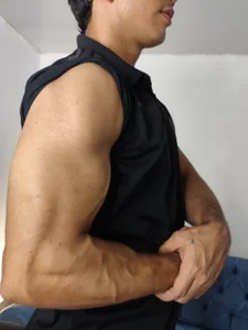 neron_vip kullanıcısının my arms albümü -  fotoğraf