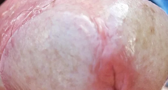 jhonschen's Idrospezione Sex Photo 9