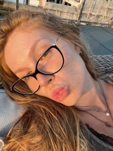 Battyredhair Me 😍 圖片 5