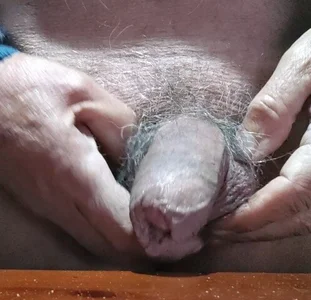 jhonschen's Gli fa male il sole Sex Photo 5