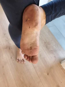 Teafeet's photo