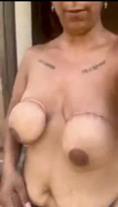 wildfarmbabe Self tits bondage Billede